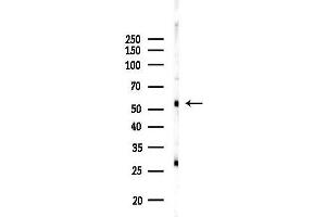 anti-serine/arginine-Rich Splicing Factor 4 (SRSF4) (Internal Region) antibody