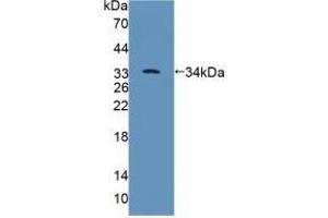 Detection of Recombinant PTPRB, Rat using Polyclonal Antibody to Protein Tyrosine Phosphatase Receptor Type B (PTPRB)