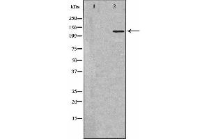 Western blot analysis of extracts of HL-60, using PLCB1 antibody.
