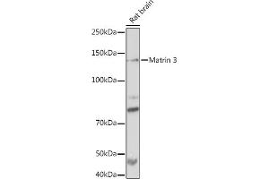 Western blot analysis of extracts of Rat brain, using Matrin 3 Rabbit mAb (ABIN7268414) at 1:1000 dilution. (MATR3 antibody)
