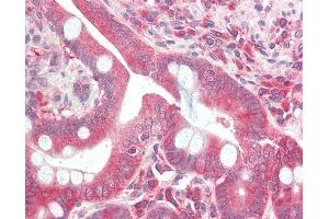 Anti-DCP2 antibody IHC staining of human small intestine. (DCP2 antibody  (C-Term))