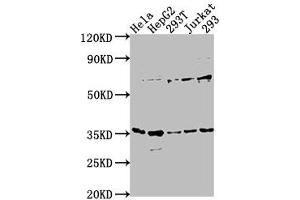 Western Blot Positive WB detected in: Hela whole cell lysate, HepG2 whole cell lysate, 293T whole cell lysate, Jurkat whole cell lysate, 293 whole cell lysate All lanes: MFF antibody at 1:1000 Secondary Goat polyclonal to rabbit IgG at 1/50000 dilution Predicted band size: 39, 33 28, 26 kDa Observed band size: 35 kDa (MFF antibody  (AA 1-322))
