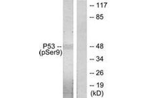 Western blot analysis of extracts from LOVO cells, using p53 (Phospho-Ser9) Antibody. (p53 antibody  (pSer9))
