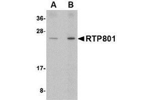 Image no. 1 for anti-DNA-Damage-Inducible Transcript 4 (DDIT4) (Internal Region) antibody (ABIN1493798)