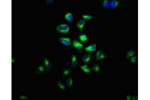 Immunofluorescence staining of Hela cells with ABIN7158126 at 1:100, counter-stained with DAPI. (LGR4 antibody  (AA 234-365))