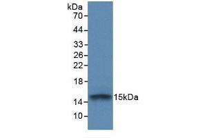 Detection of Recombinant FGFR1, Human using Monoclonal Antibody to Fibroblast Growth Factor Receptor 1 (FGFR1) (FGFR1 antibody  (AA 236-362))