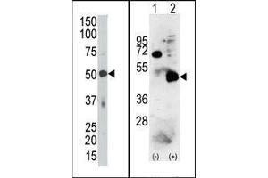(LEFT) The PDK4 Antibody (C-term) is used in Western blot to detect PDK4 in mouse skeletal muscle tissue lysate.