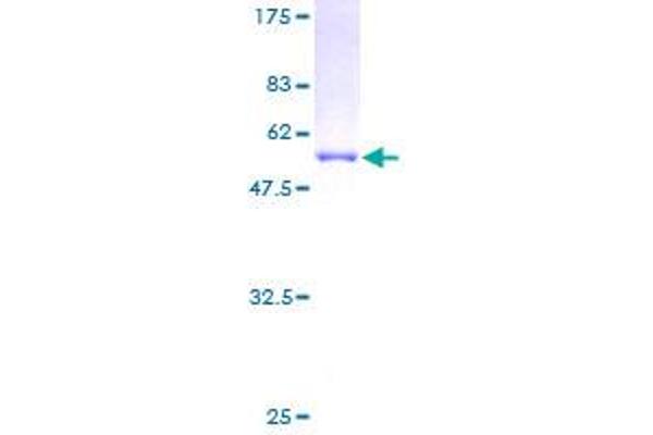 GSTT2 Protein (GST tag)