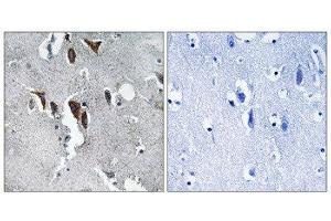 Immunohistochemistry (IHC) image for anti-ELOVL Fatty Acid Elongase 5 (ELOVL5) (C-Term) antibody (ABIN1851296) (ELOVL5 antibody  (C-Term))