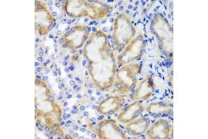 Immunohistochemistry of paraffin-embedded mouse kidney using HCLS1 antibody (ABIN3023093, ABIN3023094, ABIN3023095 and ABIN6219386) at dilution of 1:100 (40x lens). (HCLS1 antibody  (AA 1-280))