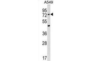 Western Blotting (WB) image for anti-Acyl-CoA Synthetase Medium-Chain Family Member 2A (ACSM2A) antibody (ABIN3000465)