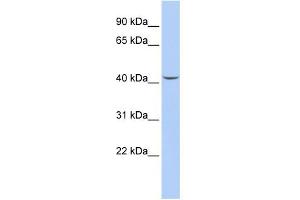 WB Suggested Anti-SEPT2 Antibody Titration: 0. (Septin 2 antibody  (Middle Region))