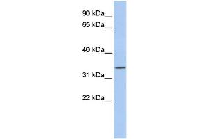 WB Suggested Anti-PITX1 Antibody Titration:  0. (PITX1 antibody  (N-Term))