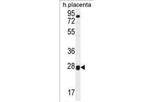 TOR2A Antibody (Center) western blot analysis in human placenta tissue lysates (35 µg/lane). (TOR2A antibody  (Middle Region))