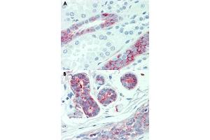 Immunohistochemical staining of human kidney (A) and human breast (B) with SLC4A2 polyclonal antibody . (SLC4A2 antibody  (Internal Region))