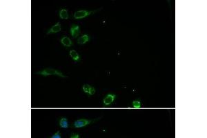 Immunofluorescence analysis of MCF-7 cells using HFE Polyclonal Antibody (HFE antibody)