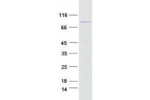 Validation with Western Blot (MSH5 Protein (Transcript Variant 3) (Myc-DYKDDDDK Tag))