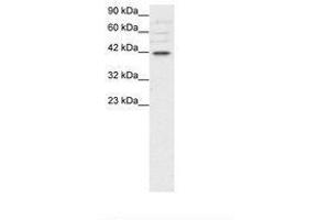 Image no. 1 for anti-POU Domain, Class 3, Transcription Factor 4 (POU3F4) (C-Term) antibody (ABIN202344) (POU3F4 antibody  (C-Term))