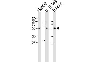 Western blot analysis of lysates from HepG2, U-87 MG cell line and human brain tissue lysate(from left to right), using RGS20 Antibody (Center) (ABIN6243829 and ABIN6577411). (RGS20 antibody  (AA 150-184))
