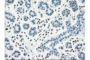 Immunohistochemical staining of paraffin-embedded breast tissue using anti-STK3 mouse monoclonal antibody. (STK3 antibody)