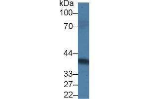 Detection of PRLR in Rat Serum using Polyclonal Antibody to Prolactin Receptor (PRLR) (Prolactin Receptor antibody  (AA 20-229))
