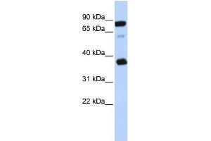 WB Suggested Anti-BCAP29 Antibody Titration:  0.