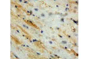 Used in DAB staining on fromalin fixed paraffin-embedded Heart tissue (Corin antibody  (AA 448-579))