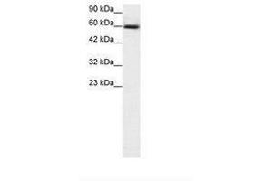 Image no. 2 for anti-GA Binding Protein Transcription Factor, alpha Subunit 60kDa (GABPA) (AA 359-408) antibody (ABIN203144) (GABPA antibody  (AA 359-408))