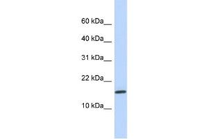 WB Suggested Anti-NCRNA00114 Antibody Titration:  0.