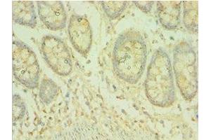 Immunohistochemistry of paraffin-embedded human colon tissue using ABIN7145070 at dilution of 1:100 (COQ8A antibody  (AA 1-220))