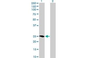 Western Blot analysis of MRAS expression in transfected 293T cell line by MRAS MaxPab polyclonal antibody. (MRAS antibody  (AA 1-208))