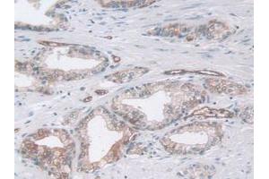 IHC-P analysis of Human Prostate Gland Tissue, with DAB staining. (Pepsin antibody)
