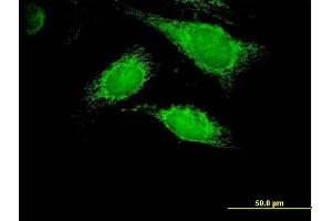 Immunofluorescence of purified MaxPab antibody to PPA2 on HeLa cell.