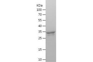 Western Blotting (WB) image for Inhibitor of Growth Family, Member 3 (ING3) (AA 1-92) protein (His-IF2DI Tag) (ABIN7283080) (ING3 Protein (AA 1-92) (His-IF2DI Tag))