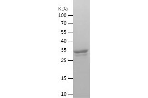 ING3 Protein (AA 1-92) (His-IF2DI Tag)