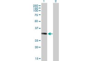 Western Blot analysis of LYSMD2 expression in transfected 293T cell line by LYSMD2 MaxPab polyclonal antibody. (LYSMD2 antibody  (AA 1-215))