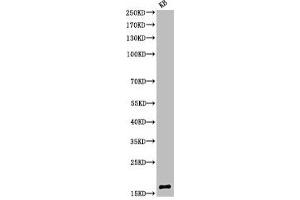 Western Blot analysis of KB cells using Acetyl-Histone H3 (K9) Polyclonal Antibody (HIST1H3A/HIST2H3A/H3F3A (acLys9) antibody)