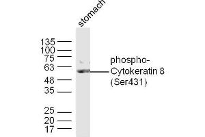 Mouse stomach lysates probed with Cytokeratin 8 (Ser431) Polyclonal Antibody, Unconjugated  at 1:300 dilution and 4˚C overnight incubation. (KRT8 antibody  (pSer431))