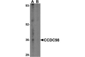 Western Blotting (WB) image for anti-Family with Sequence Similarity 175, Member A (FAM175A) (N-Term) antibody (ABIN1031306) (CCDC98 antibody  (N-Term))