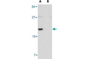 Western blot analysis of MED28 in human brain tissue lysate with MED28 polyclonal antibody  at 1 ug/mL in (A) the absence and (B) the presence of blocking peptide.