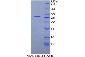 SDS-PAGE analysis of Rat TGFb1I1 Protein.