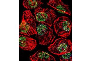 Immunofluorescence (IF) image for anti-TATA Box Binding Protein (TBP) antibody (ABIN3002745) (TBP antibody)