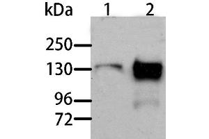 Western Blot analysis of Human liver cancer and normal liver tissue using AOX1 Polyclonal Antibody at dilution of 1:1000 (AOX1 antibody)