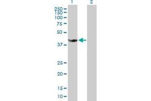 Western Blot analysis of STOML1 expression in transfected 293T cell line by STOML1 MaxPab polyclonal antibody. (STOML1 antibody  (AA 1-398))