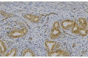 ABIN6277529 at 1/100 staining Human uterus tissue by IHC-P.