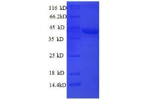 Superoxide Dismutase 1, Soluble (SOD1) (AA 2-154), (full length) protein (GST tag) (SOD1 Protein (AA 2-154, full length) (GST tag))