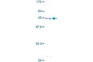 IDS Protein (AA 1-312) (GST tag)