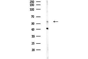 anti-Cyclin-Dependent Kinase Inhibitor 1C (p57, Kip2) (CDKN1C) (C-Term) antibody