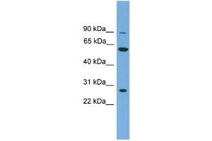 WB Suggested Anti-IMPDH2  Antibody Titration: 0. (IMPDH2 antibody  (N-Term))