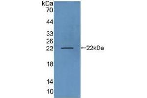 Detection of Recombinant LAMP3, Human using Polyclonal Antibody to Lysosomal Associated Membrane Protein 3 (LAMP3) (LAMP3 antibody  (AA 222-381))